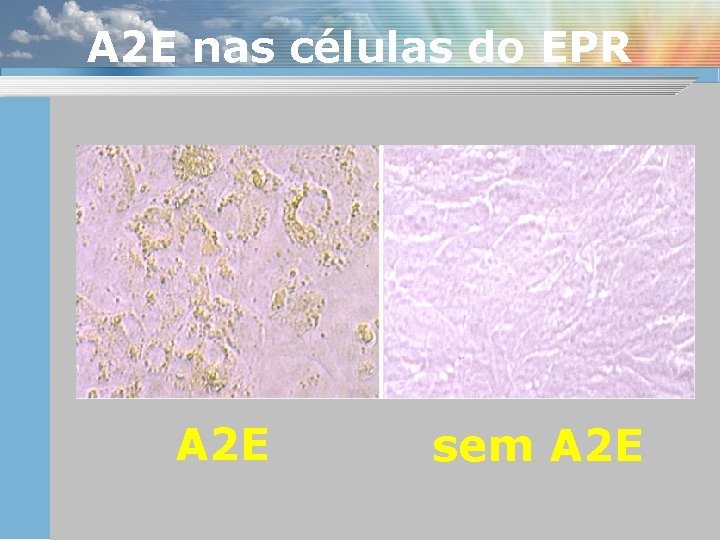 A 2 E nas células do EPR A 2 E sem A 2 E