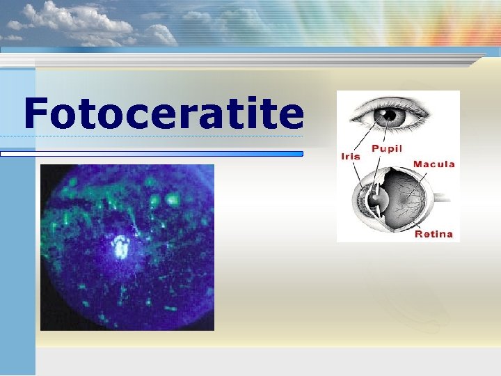 Fotoceratite 