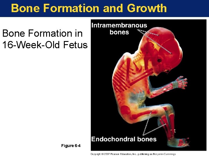 Bone Formation and Growth Bone Formation in 16 -Week-Old Fetus Figure 6 -4 