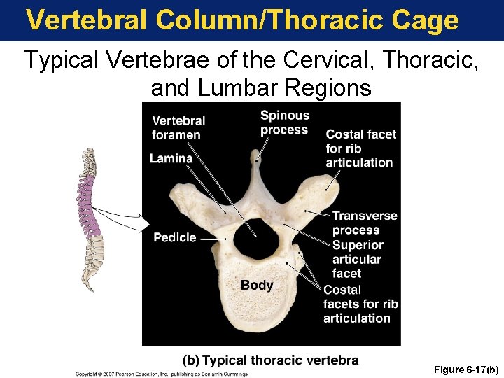 Vertebral Column/Thoracic Cage Typical Vertebrae of the Cervical, Thoracic, and Lumbar Regions Figure 6