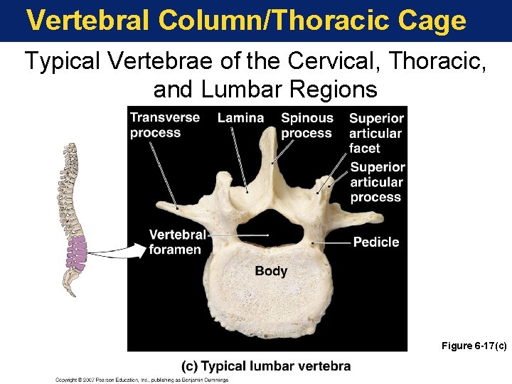 Vertebral Column/Thoracic Cage Typical Vertebrae of the Cervical, Thoracic, and Lumbar Regions Figure 6