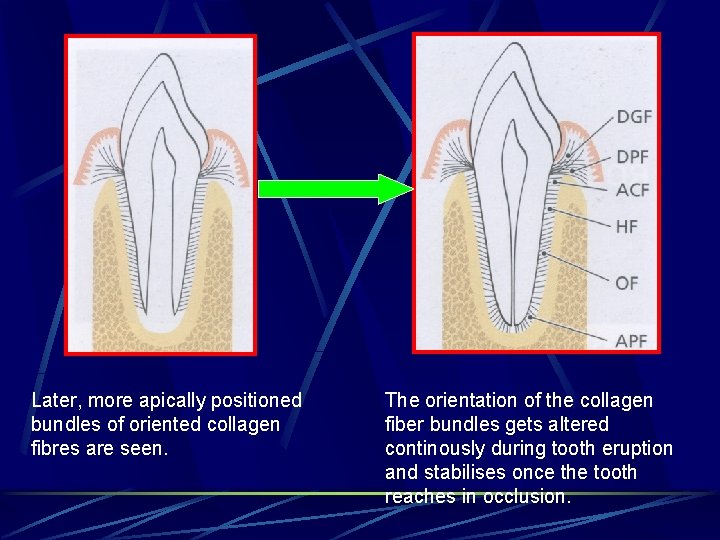 Later, more apically positioned bundles of oriented collagen fibres are seen. The orientation of