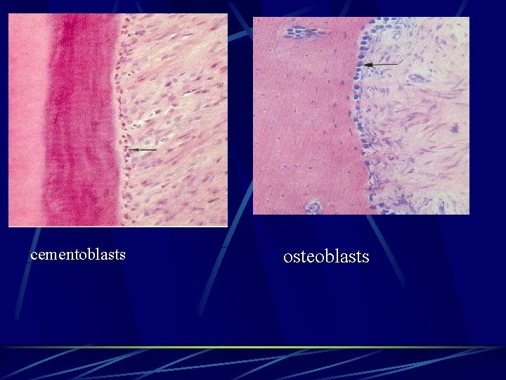 cementoblasts osteoblasts 
