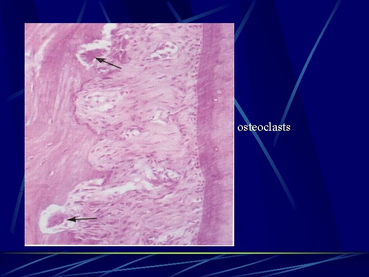 osteoclasts 