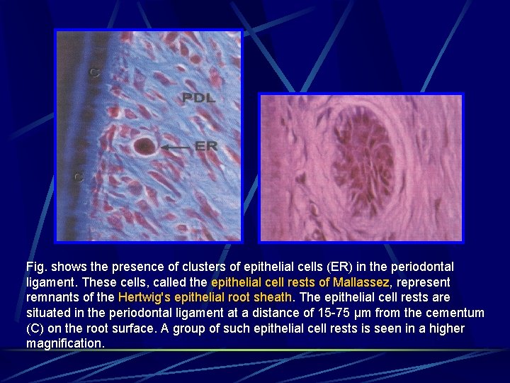 Fig. shows the presence of clusters of epithelial cells (ER) in the periodontal ligament.