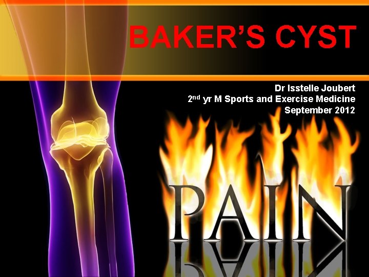 BAKER’S CYST Dr Isstelle Joubert 2 nd yr M Sports and Exercise Medicine September