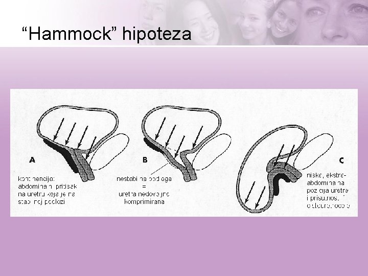 “Hammock” hipoteza 