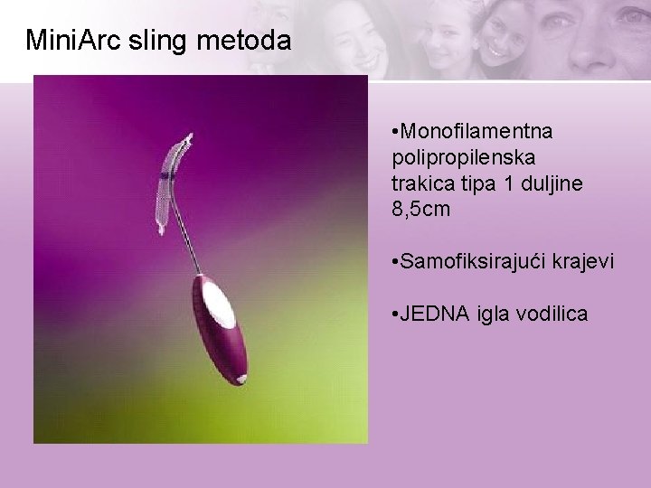 Mini. Arc sling metoda - • Monofilamentna polipropilenska trakica tipa 1 duljine 8, 5