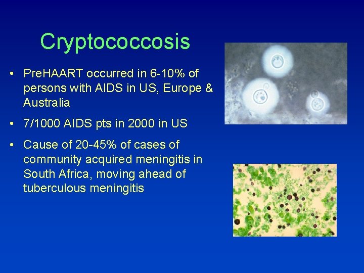 Cryptococcosis • Pre. HAART occurred in 6 -10% of persons with AIDS in US,