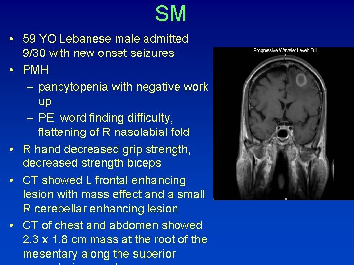 SM • 59 YO Lebanese male admitted 9/30 with new onset seizures • PMH