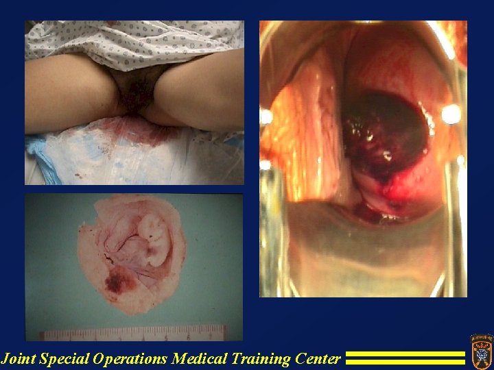 Joint Special Operations Medical Training Center Joint Special Operations Medical Training Center