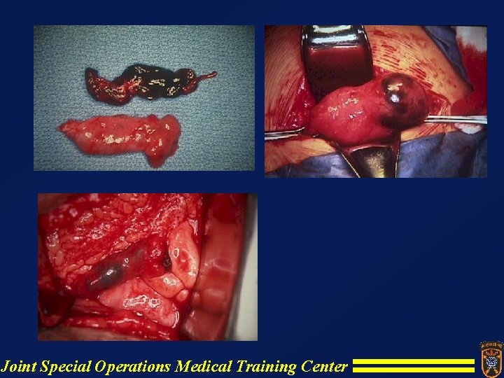 Joint Special Operations Medical Training Center Joint Special Operations Medical Training Center