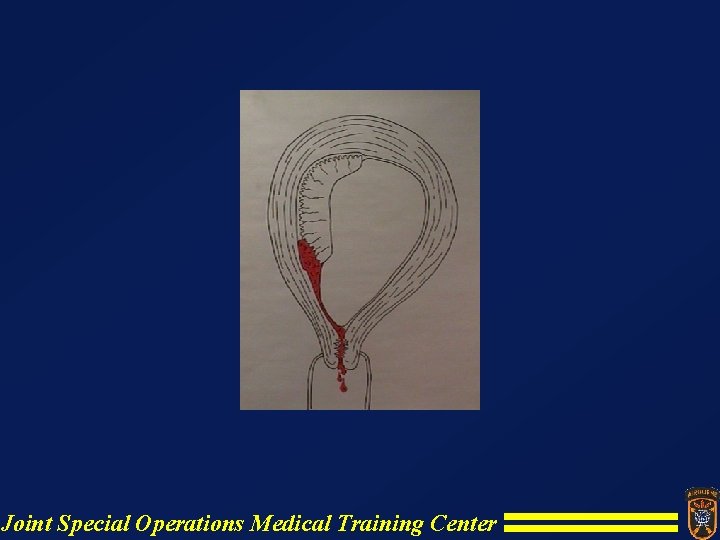 Joint Special Operations Medical Training Center Joint Special Operations Medical Training Center