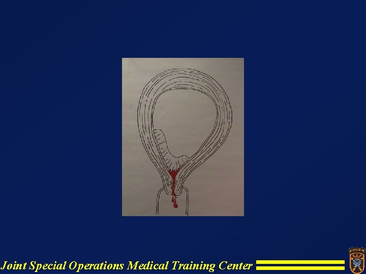 Joint Special Operations Medical Training Center Joint Special Operations Medical Training Center