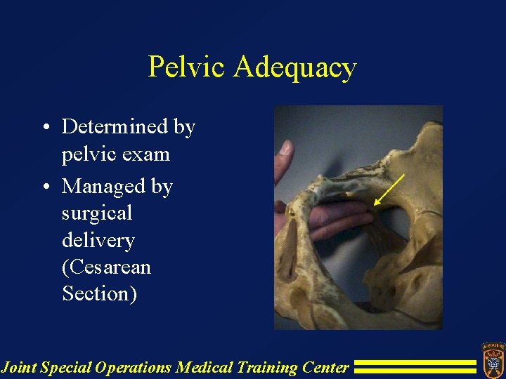 Pelvic Adequacy • Determined by pelvic exam • Managed by surgical delivery (Cesarean Section) Pelvic Adequacy • Determined by pelvic exam • Managed by surgical delivery (Cesarean Section)