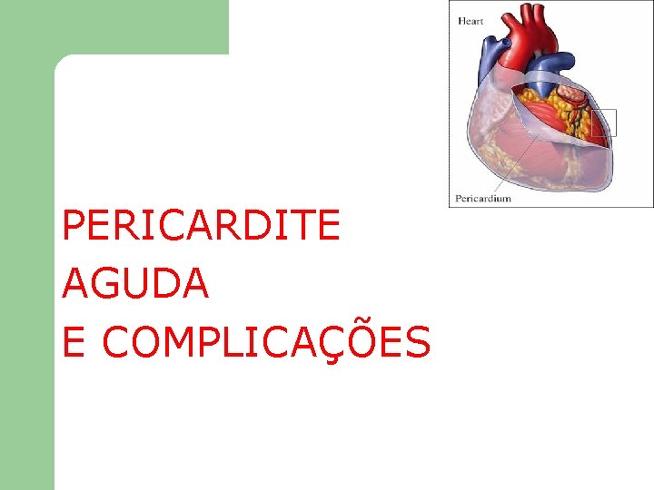 PERICARDITE AGUDA E COMPLICAÇÕES 