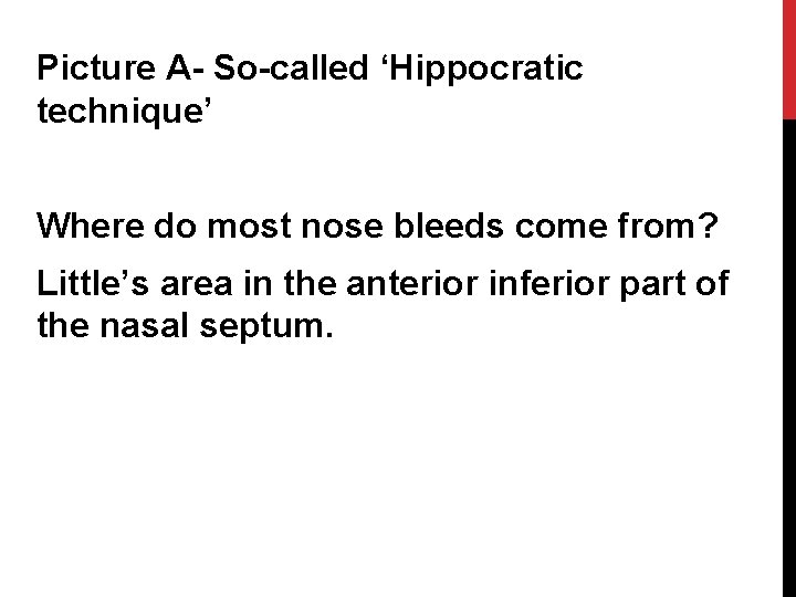 Picture A- So-called ‘Hippocratic technique’ Where do most nose bleeds come from? Little’s area