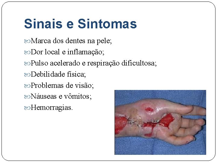 Sinais e Sintomas Marca dos dentes na pele; Dor local e inflamação; Pulso acelerado