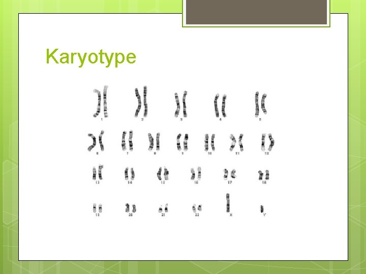 Karyotype 