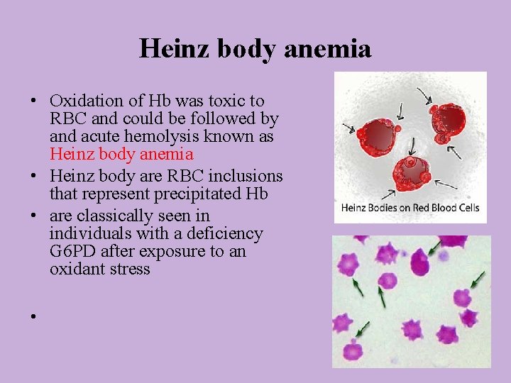 Heinz body anemia • Oxidation of Hb was toxic to RBC and could be