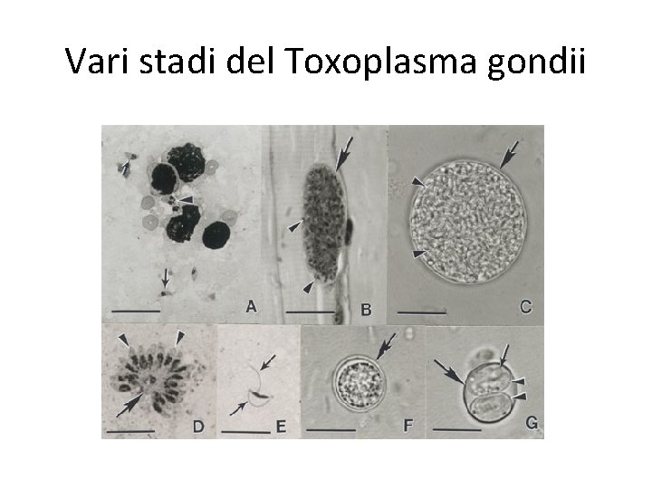 Vari stadi del Toxoplasma gondii 