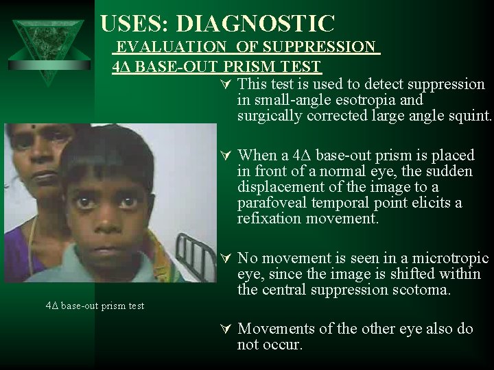 USES: DIAGNOSTIC EVALUATION OF SUPPRESSION 4Δ BASE-OUT PRISM TEST Ú This test is used USES: DIAGNOSTIC EVALUATION OF SUPPRESSION 4Δ BASE-OUT PRISM TEST Ú This test is used