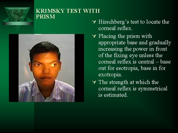 KRIMSKY TEST WITH PRISM Ú Hirschberg’s test to locate the corneal reflex. Ú Placing KRIMSKY TEST WITH PRISM Ú Hirschberg’s test to locate the corneal reflex. Ú Placing