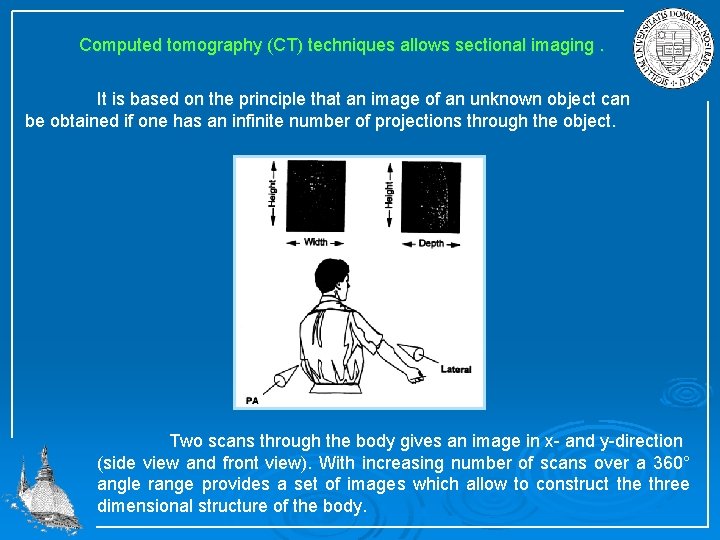 Computed tomography (CT) techniques allows sectional imaging. It is based on the principle that
