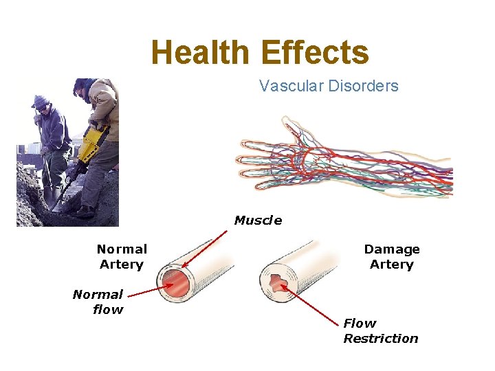 Health Effects Vascular Disorders Muscle Normal Artery Normal flow Damage Artery Flow Restriction 