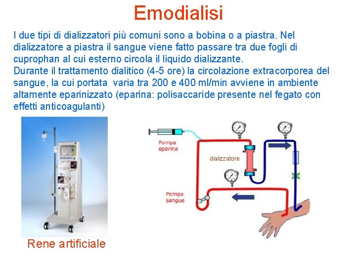 Emodialisi I due tipi di dializzatori più comuni sono a bobina o a piastra. Emodialisi I due tipi di dializzatori più comuni sono a bobina o a piastra.