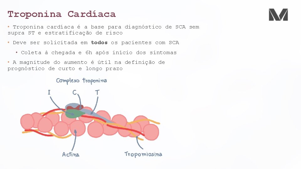 Troponina Cardíaca • Troponina cardíaca é a base para diagnóstico de SCA sem supra