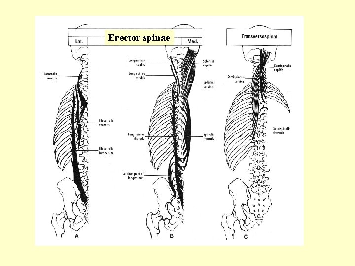 Erector spinae 