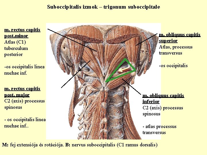 Suboccipitalis izmok – trigonum suboccipitale m. rectus capitis post. minor Atlas (C 1) tuberculum