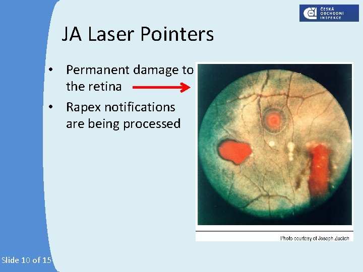 JA Laser Pointers • Permanent damage to the retina • Rapex notifications are being