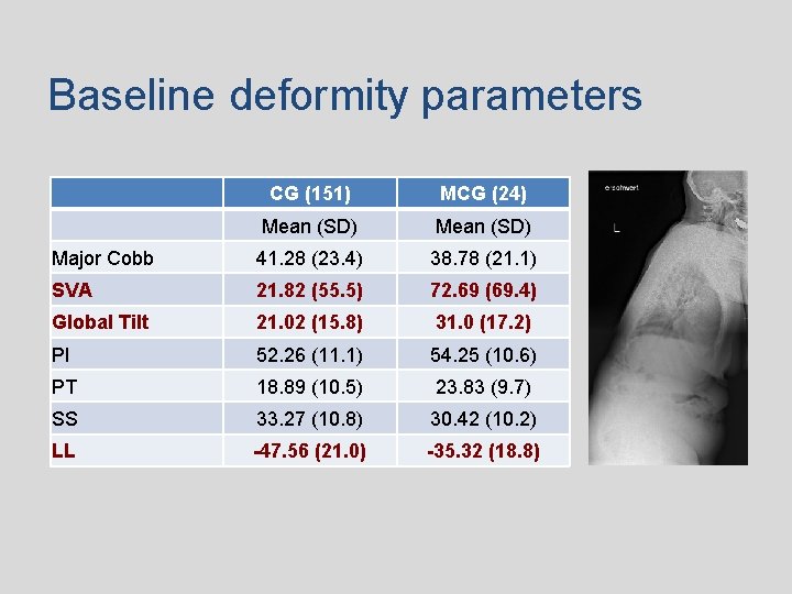 Baseline deformity parameters CG (151) MCG (24) Mean (SD) Major Cobb 41. 28 (23.