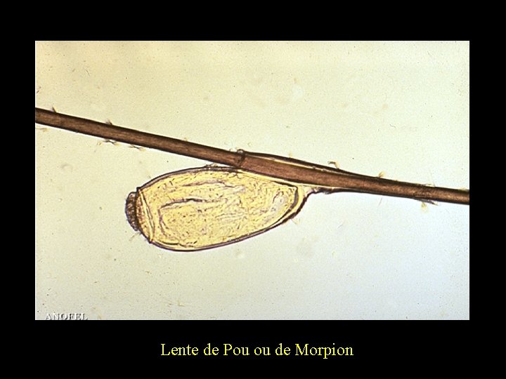 ECTOPARASITES ARTHROPODES INSECTES ACARIENS INSECTES 3 paires de