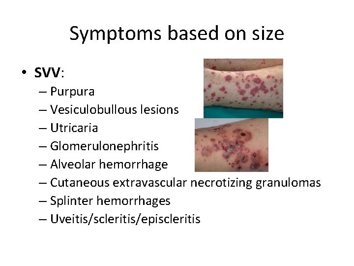 Symptoms based on size • SVV: – Purpura – Vesiculobullous lesions – Utricaria –