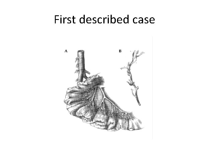 First described case 