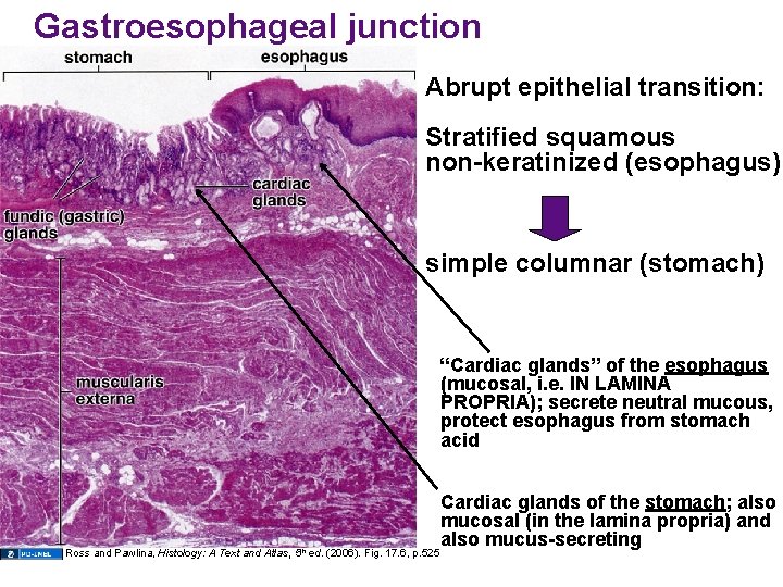 Gastroesophageal junction Abrupt epithelial transition: Stratified squamous non-keratinized (esophagus) simple columnar (stomach) “Cardiac glands”