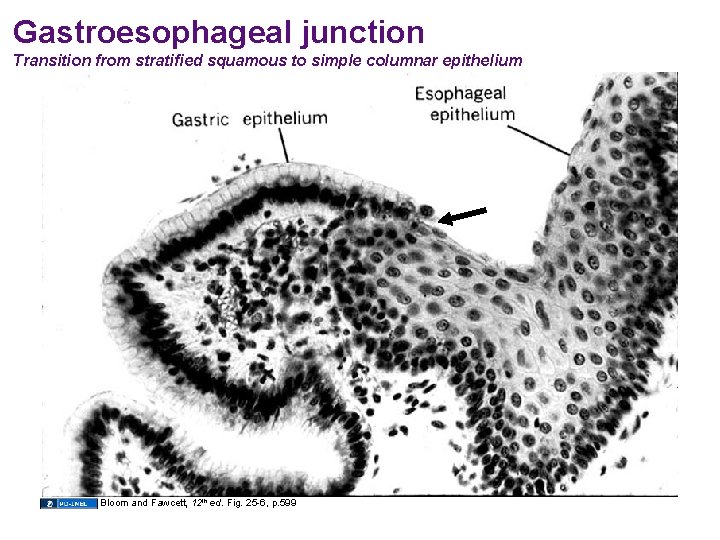 Gastroesophageal junction Transition from stratified squamous to simple columnar epithelium Bloom and Fawcett, 12