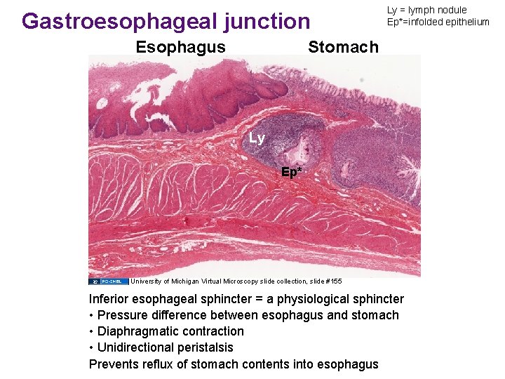 Gastroesophageal junction Esophagus Ly = lymph nodule Ep*=infolded epithelium Stomach Ly Ep* University of