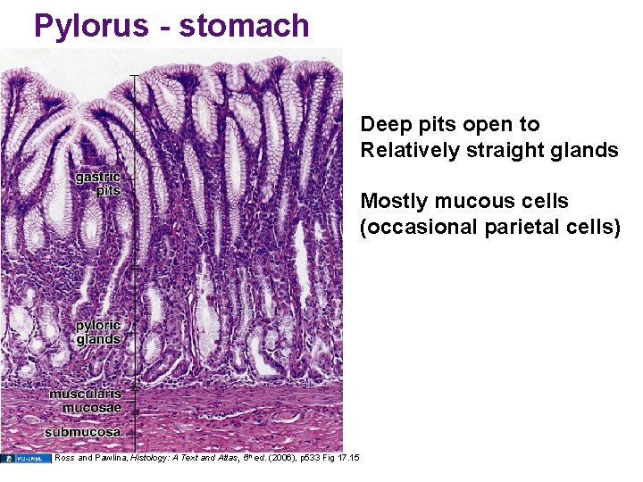 Pylorus - stomach Deep pits open to Relatively straight glands Mostly mucous cells (occasional