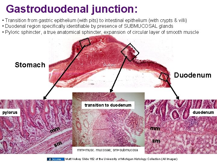 Gastroduodenal junction: • Transition from gastric epithelium (with pits) to intestinal epithelium (with crypts