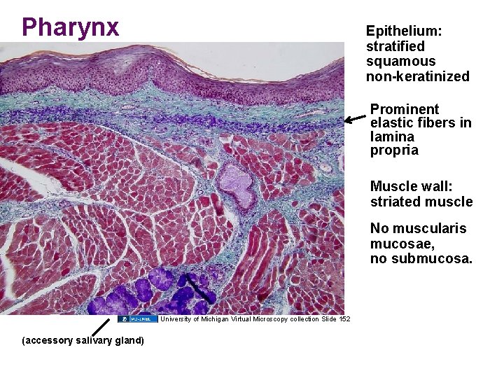 Pharynx Epithelium: stratified squamous non-keratinized Prominent elastic fibers in lamina propria Muscle wall: striated