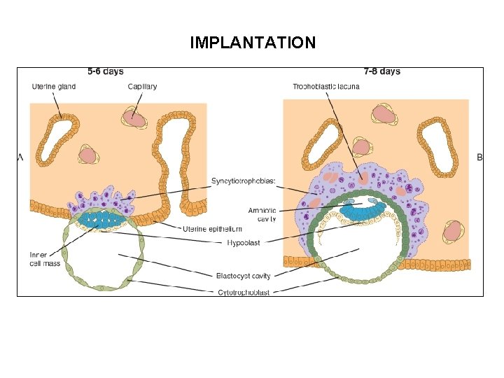 IMPLANTATION 