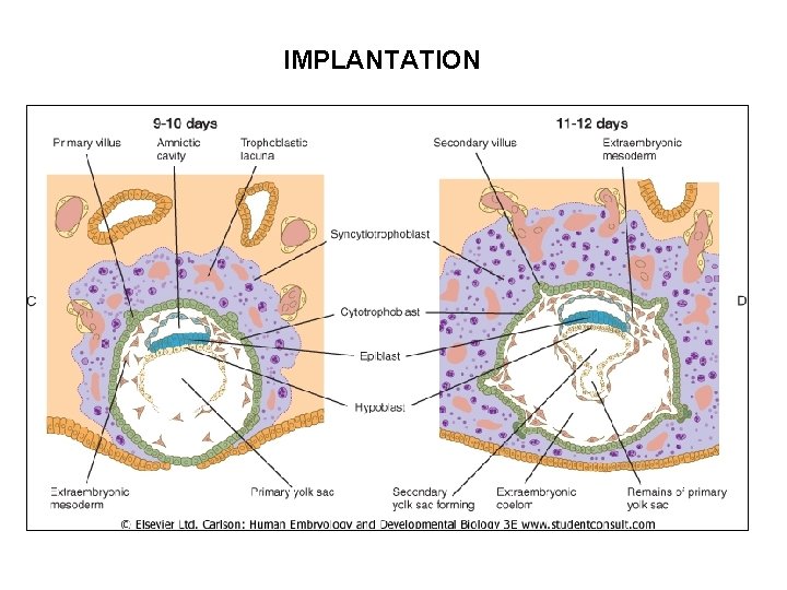 IMPLANTATION 