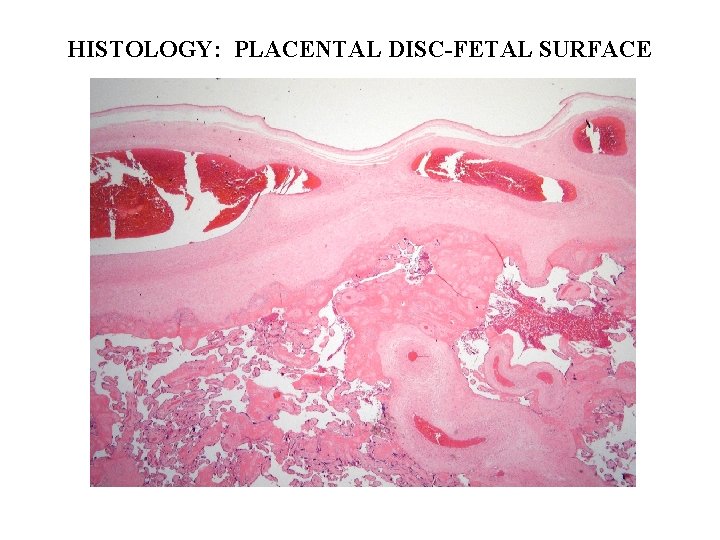 HISTOLOGY: PLACENTAL DISC-FETAL SURFACE 