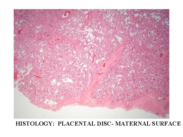 HISTOLOGY: PLACENTAL DISC- MATERNAL SURFACE 