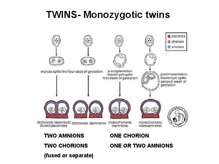 TWINS- Monozygotic twins TWO AMNIONS ONE CHORION TWO CHORIONS ONE OR TWO AMNIONS (fused