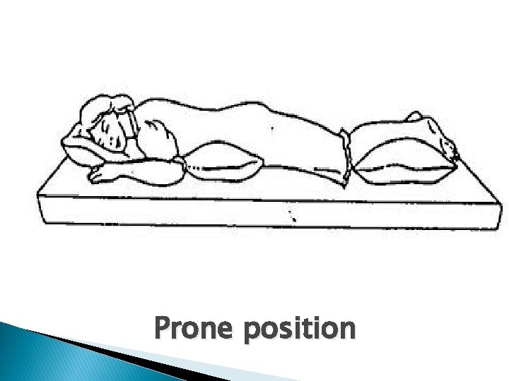 Prone position 